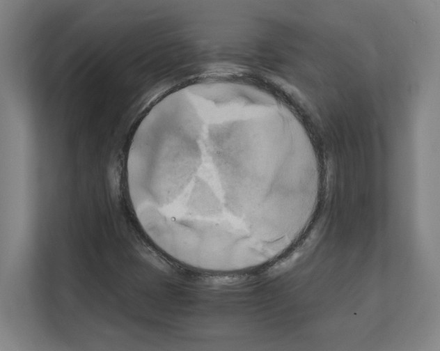 X0000111151401200908111124