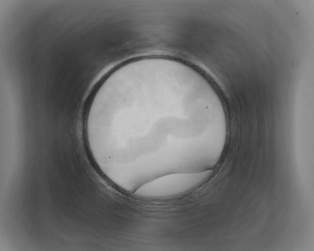 X0000111151460200908111124