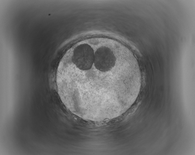 X0000111151494200908111123