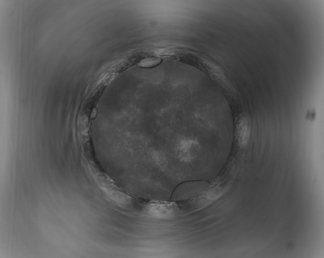 X0000111160571200906301403