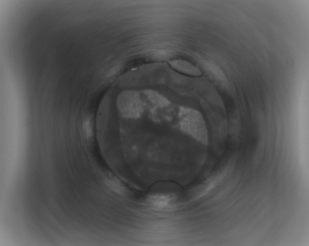 X0000111160131200907071136