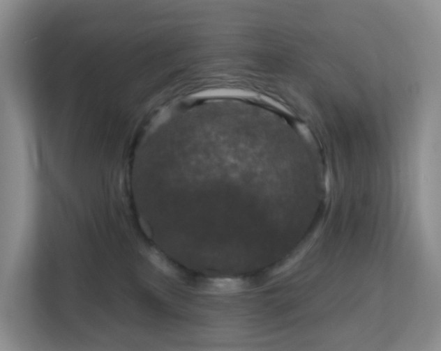 X0000111160233200907071135