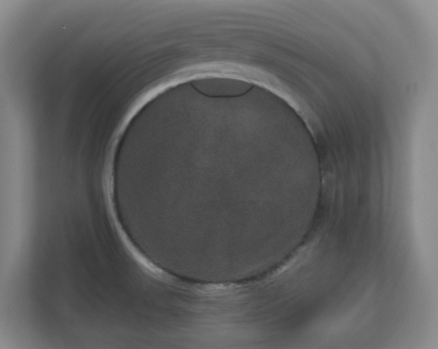 X0000111161523200907071119