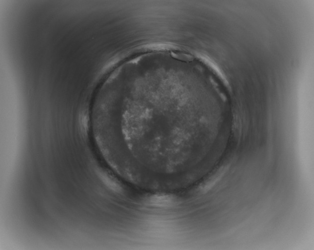X0000111160063200907141410