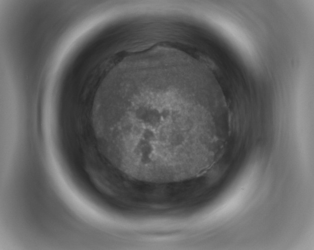 X0000111160191200907141409
