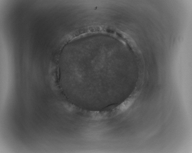 X0000111160192200907141409