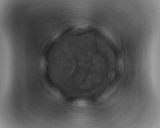 X0000111160228200907141408