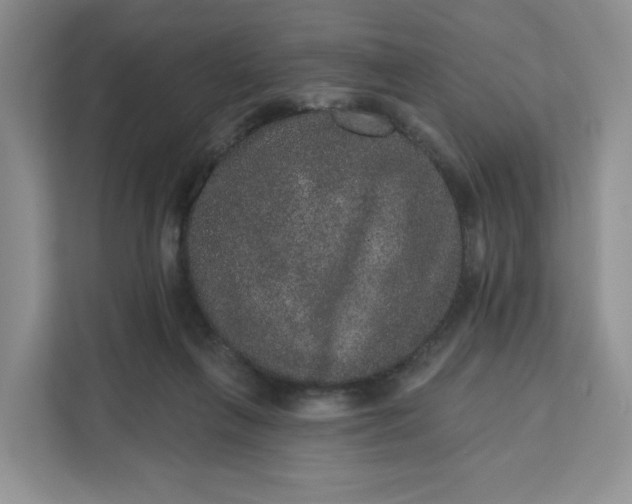 X0000111160263200907141407