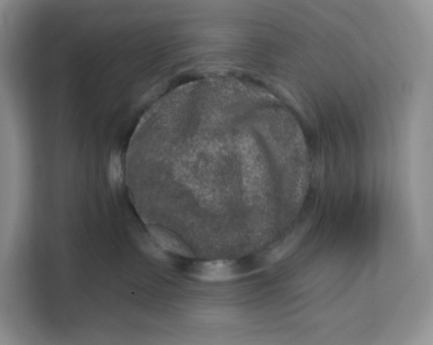 X0000111160335200907141407