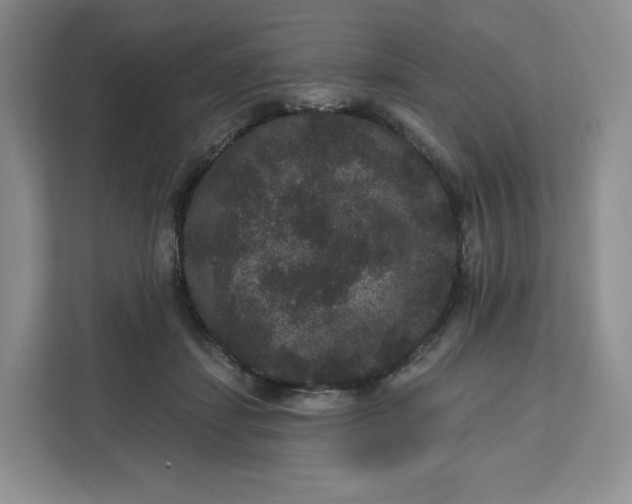 X0000111160459200907141405