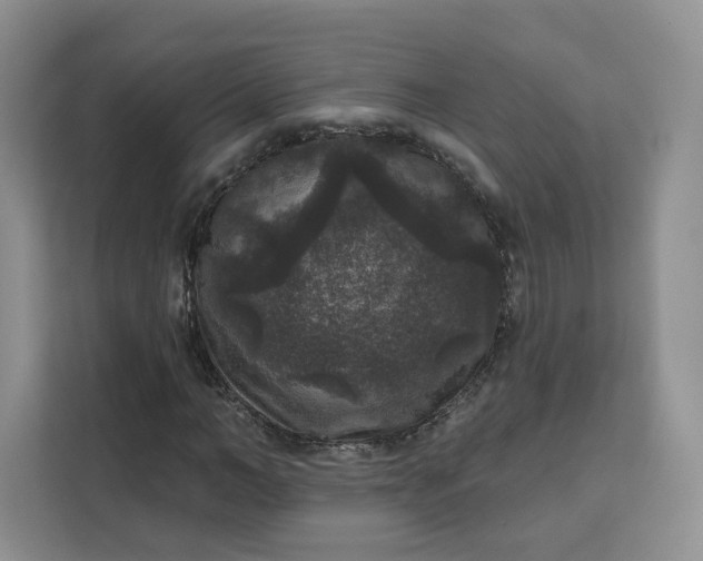 X0000111160966200907141358