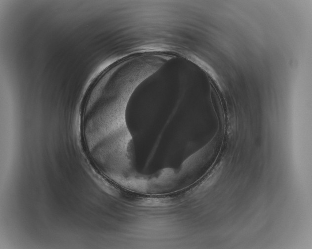 X0000111161179200907141355