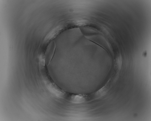 X0000111160180200907211235