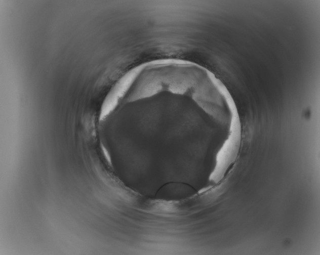 X0000111160182200907211235