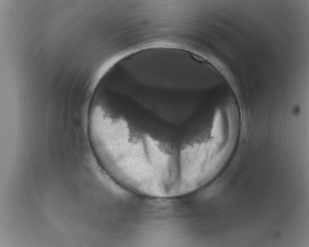 X0000111160862200907211225