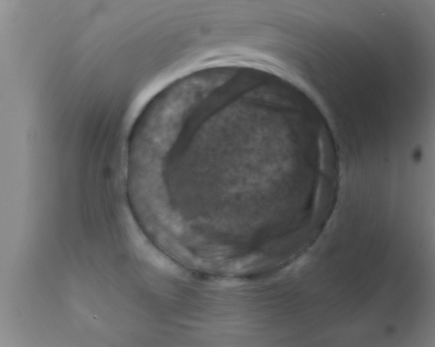 X0000111161522200907211215