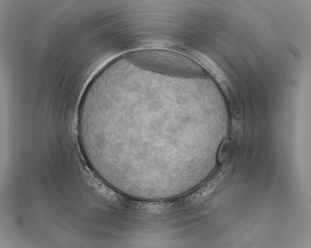 X0000111160948200907281150