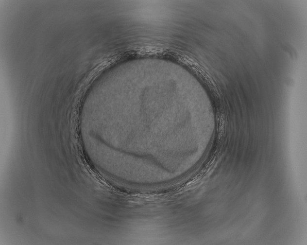 X0000111161153200907281147