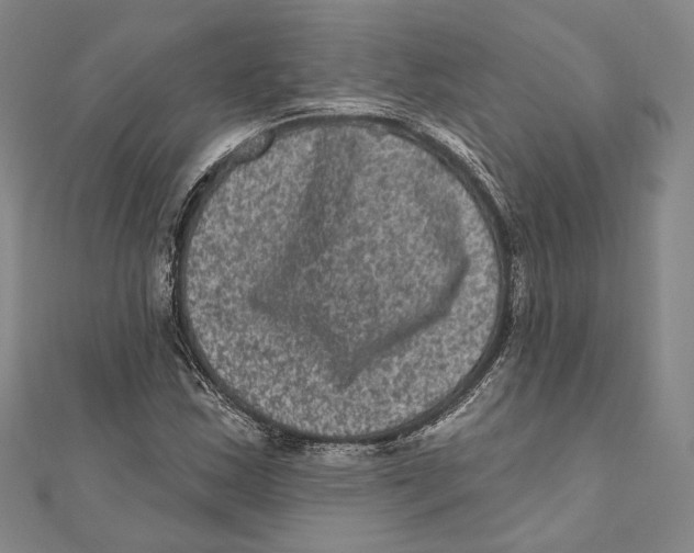 X0000111161163200907281147