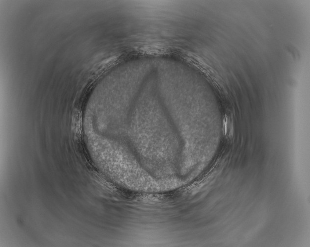 X0000111161251200907281145