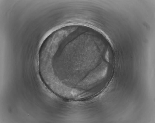 X0000111161522200907281142