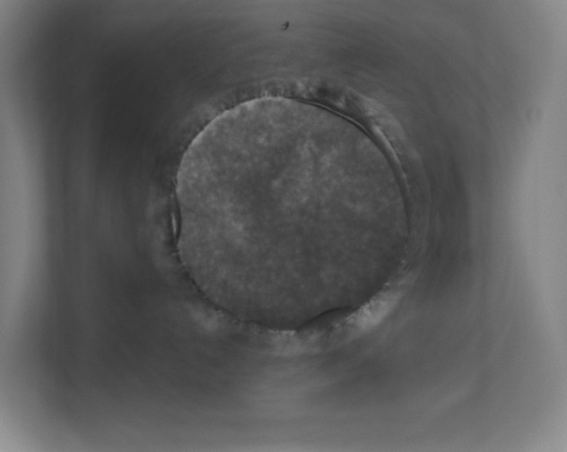 X0000111160192200908111201