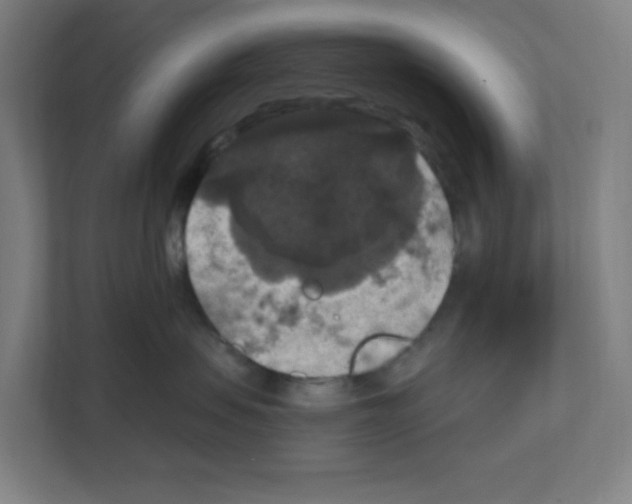 X0000111160479200908111157