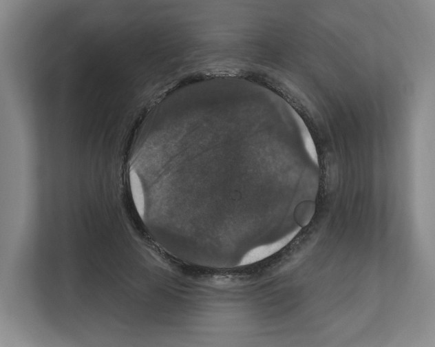 X0000111160641200908111154