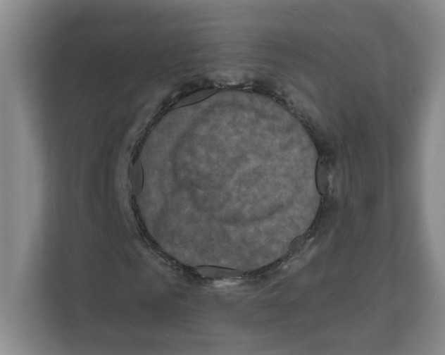 X0000111160961200908111151