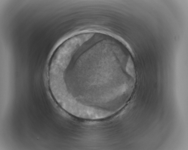 X0000111161522200908111144