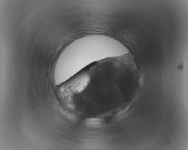 X0000111170179200907011017