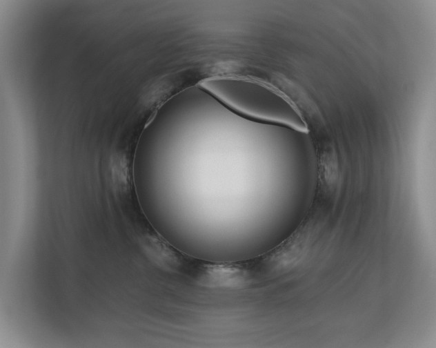 X0000111170380200907011354