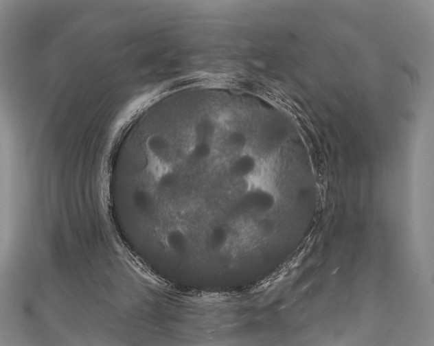 X0000111170149200907081222