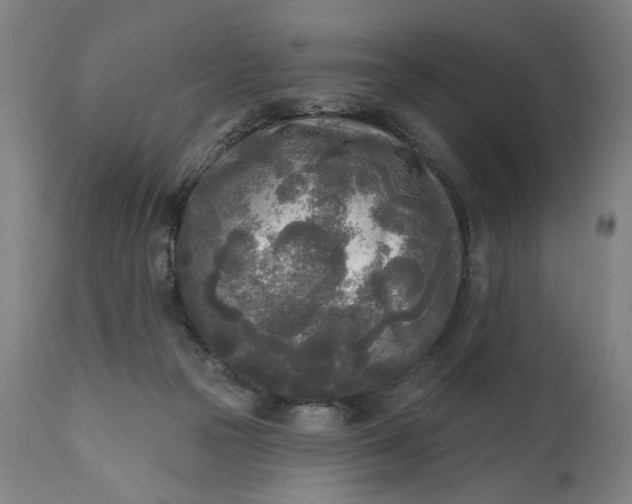 X0000111170169200907151308