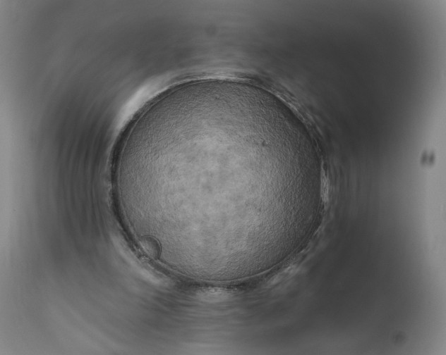 X0000111170198200907151307