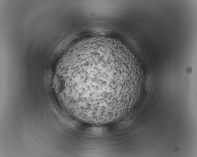 X0000111170314200907151306