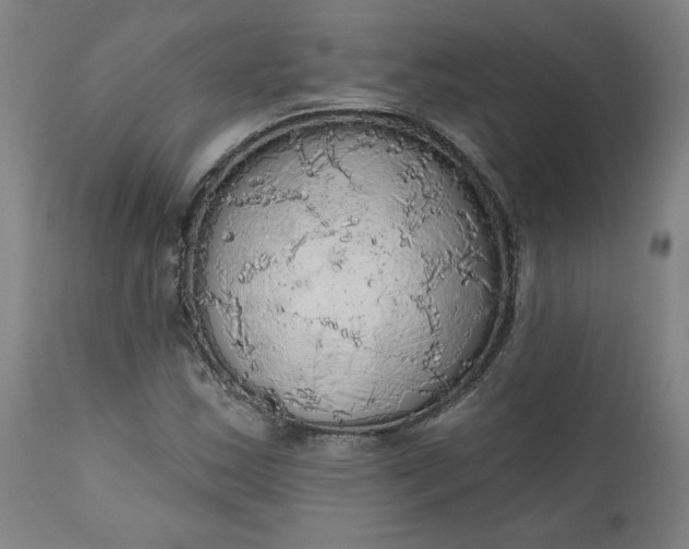 X0000111171163200907151252