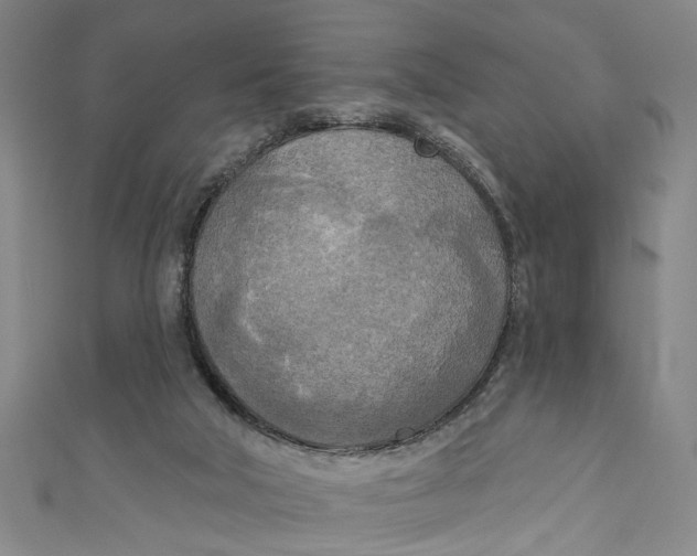 X0000111170018200907221037