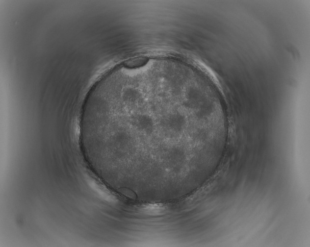 X0000111170059200907221036