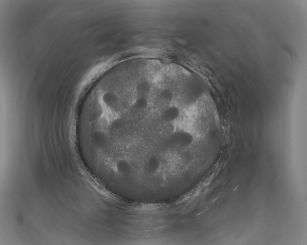 X0000111170149200907221035