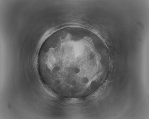 X0000111170151200907221035