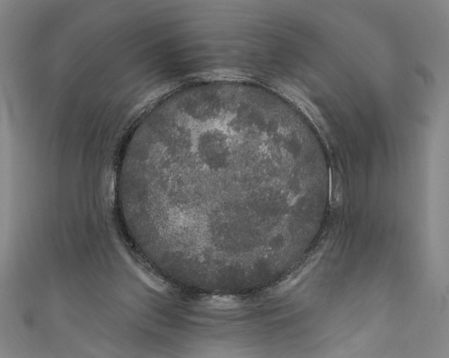 X0000111170157200907221035