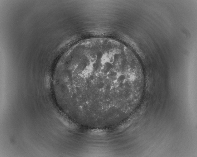 X0000111170161200907221035