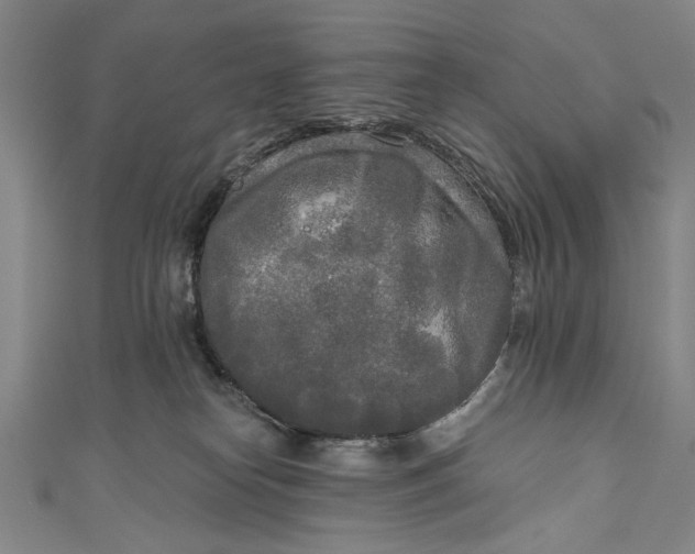 X0000111170182200907221035