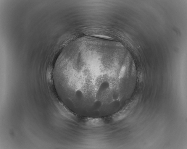 X0000111170185200907221035