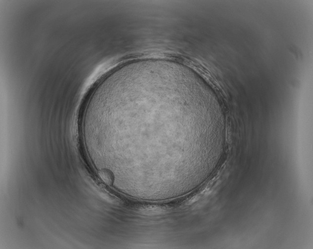 X0000111170198200907221035