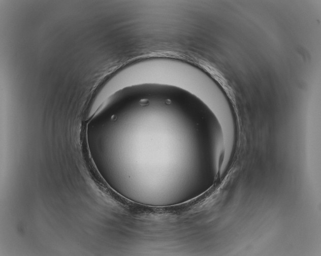 X0000111170201200907221035