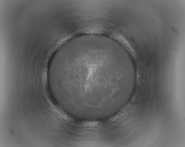 X0000111170202200907221035