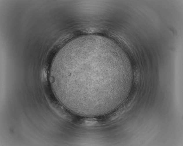 X0000111170214200907221035