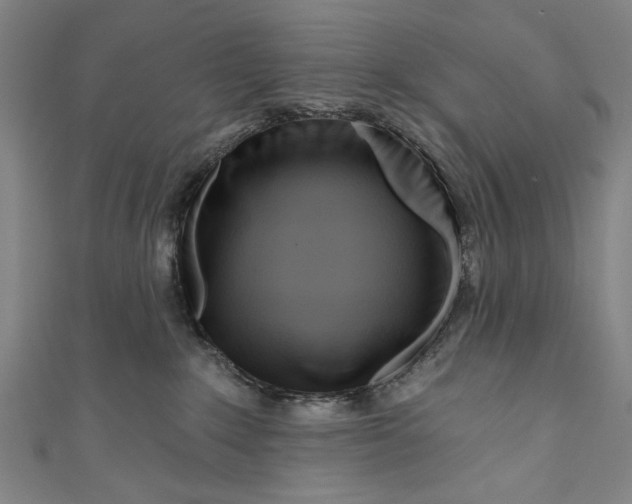 X0000111170235200907221034